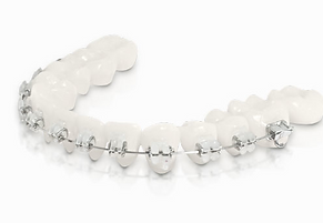 Ortodoncia en Bogota