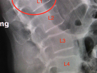 Ortho Hors D'oeuvres (Answer):