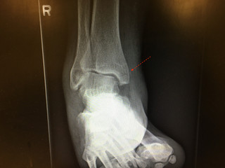 Ortho Hors D'oeuvres (Answer):