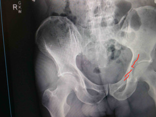 Ortho Hors D'oeuvres (Answer):