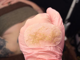 Dermaplaning: Will Your Hair Come Back Thicker?