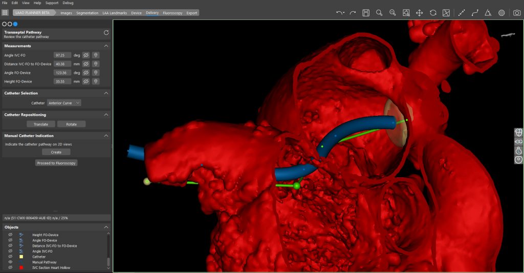 Inspecting-a-patient-3D-scan-in-Mimics-Enlight.-Image-via-Materialise.-1024x533