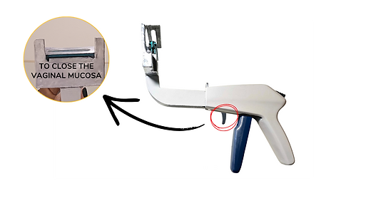Vaginal Cuff Stapler Image