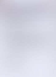 NOTICE OF AWARD - PURCHASE OF LABORATORY SUPPLIES