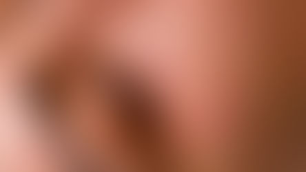 Polynucleotides: a revolutionary treatment everyone's talking about in aesthetics