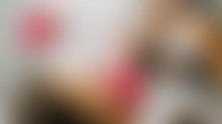 Lip filler Aftercare: Everything you need to know for a smooth recovery.