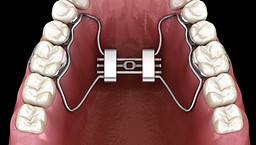expander-1.jpg