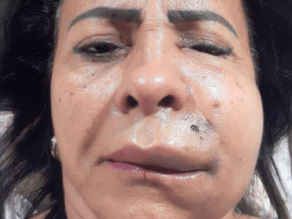 Advogado orienta o que paciente deve fazer para evitar erros em procedimentos estéticos