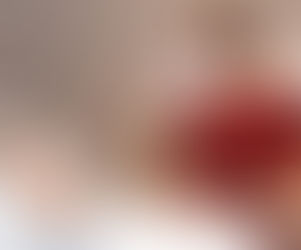 Hospital Santa Lúcia realiza primeira cirurgia com coração artificial