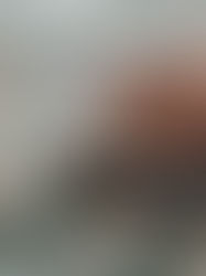 Pré-Carnaval acende alerta para estoques críticos de sangue tipos O- e O+