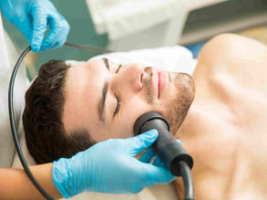 Barba cheia e bem delineada: quais são os tratamentos estéticos mais indicados?