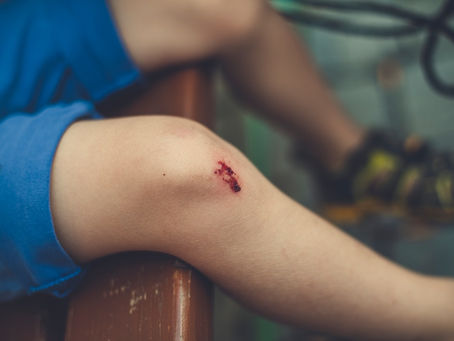 Recent Burn Injury Verdicts in New York: How Apartment Fires, Scalding, and Workplace Explosions Produce Multi-Million Dollar Awards
