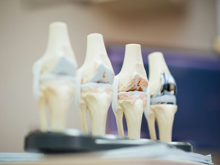 Why a Future Knee Replacement Recommendation Can Double a New York Tibial Plateau Fracture Verdict — If Your Surgeon Says It Right