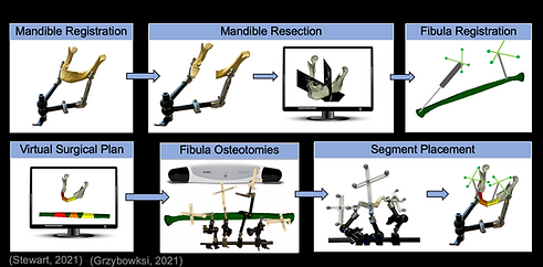 image guided surgery workflow