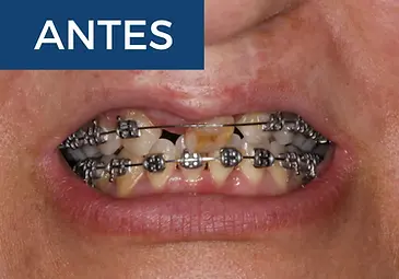 casos reales ortodoncia