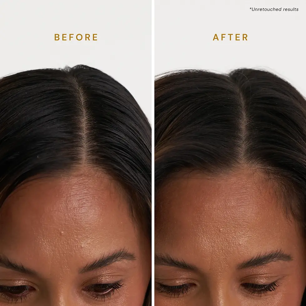 Thumbnail: Signature Dry Shampoo
