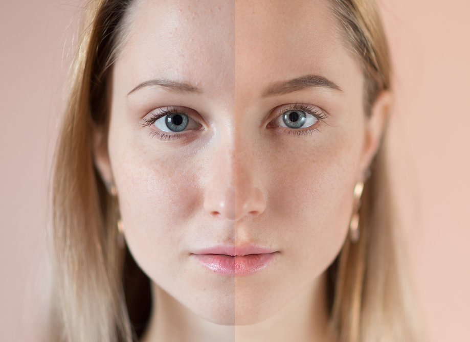 Before and After