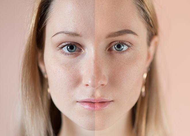 microderm abrasion e skin forte ashburn va