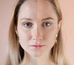 Before and After