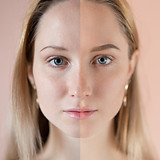 Before and After
