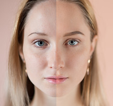 Before and After