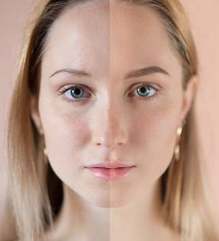 Before and After