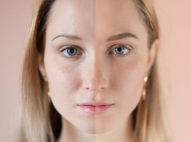 Before and After