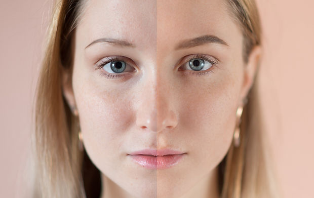 Retinolpeeling Gesichstbehandlung, chemisches peeling, retinolbooster