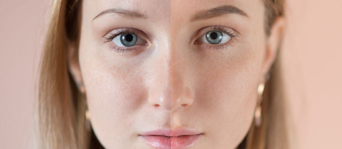 Απόκτησε τα ομορφότερα φρύδια κάθε ημέρα με αυτή την τεχνική!