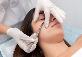Dermaplaning-in-Melbourne.jpeg