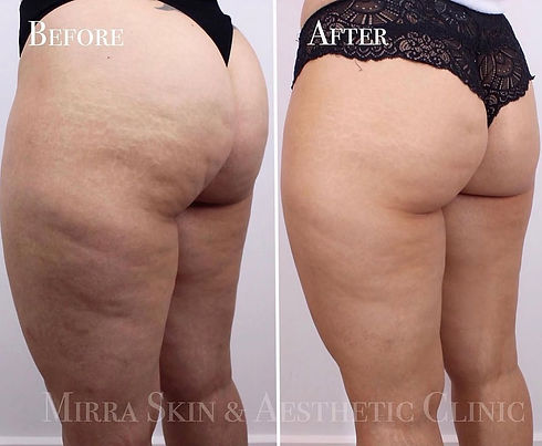 SUMMER SAVINGS PACKAGES EXTENDED ✨⚡️Buy 5 sessions get 2 FREE! HURRY Offer ends January 31