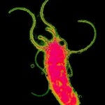 Helicobacter pylori bacterium