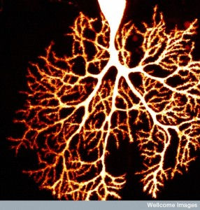 How Do Dendrites Make Decisions