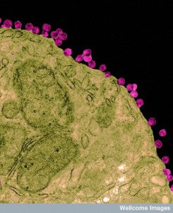 B0005755 HIV particles budding from a lymphocyte