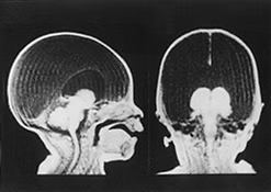 Can Human Brains Generate Human Minds?