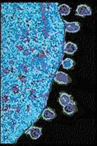 PD HIV_Daughter_Particles