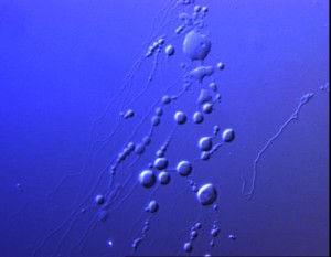 Sarfus.LipidVesicles