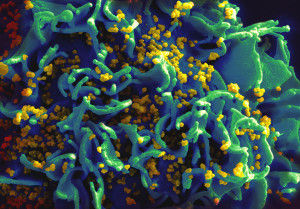 PD Infected T cell 2048px-HIV_H9_T-cell_II