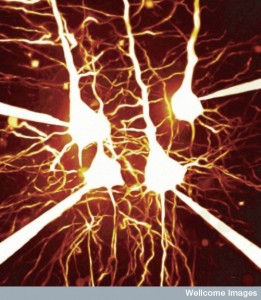 B0007846 Pyramidal neurons