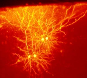 RED Mouse_cingulate_cortex_neurons