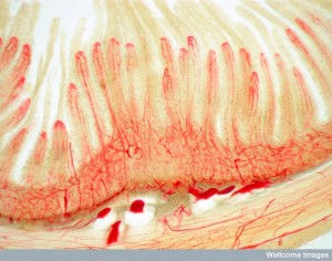 B0006289 Blood vessels in the ileum