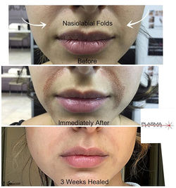 72118471_559516764868265_444748268604057