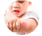 asian-boy-with-abrasion-his-elbow.png
