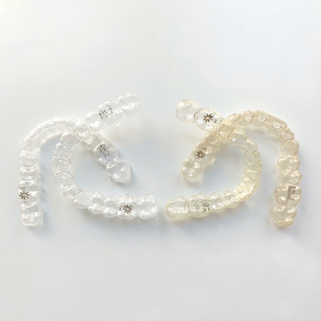 Invisalign Behandlung — verfärbte Zähne & eine verfärbte Schiene