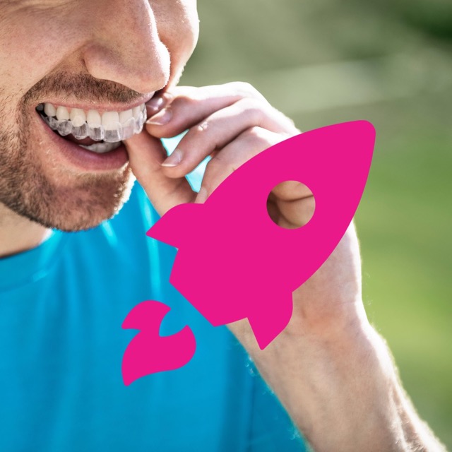 Invisalign Dauer: pro Schiene, die Anfertigung und Behandlung
