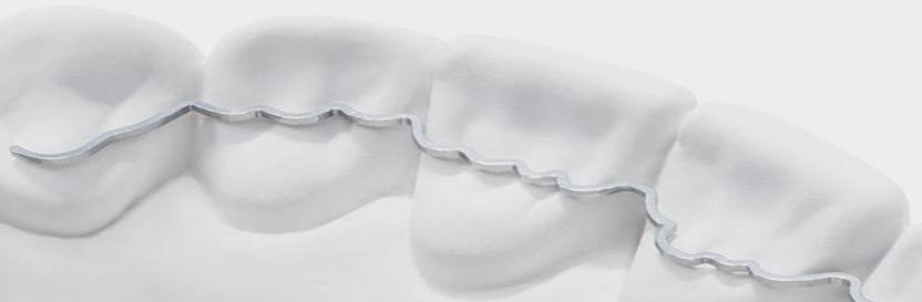 Invisalign Retainer: die Vor- und Nachteile der verschiedenen Retainer