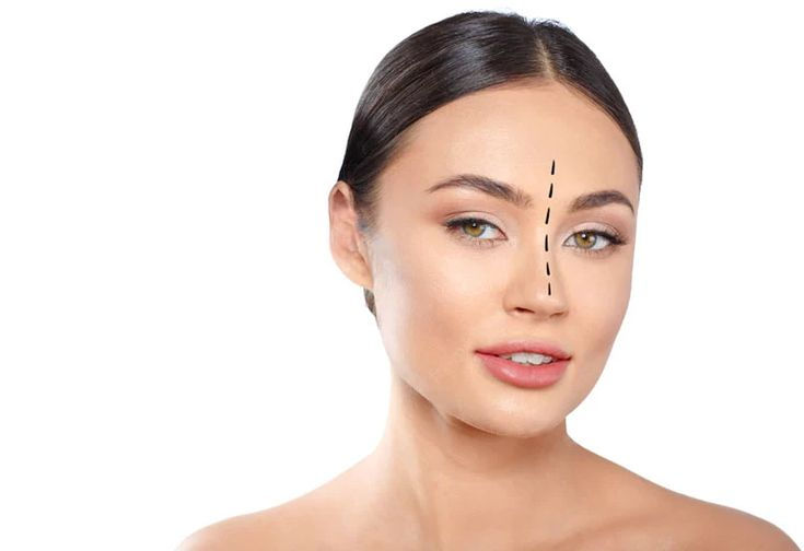 Fleshy Nose Rhinoplasty_ Procedure & Recovery - Raadina Health.jpg