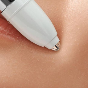 Plasma Pen Australia: How It Works, Benefits & What To Expect