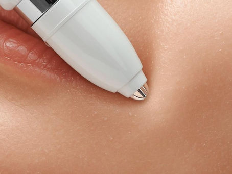 Plasma Pen Australia: How It Works, Benefits & What To Expect