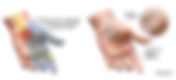 Carpal Tunnel Syndrome: Why Chiropractic Care Should Be Your First Line of Defense
